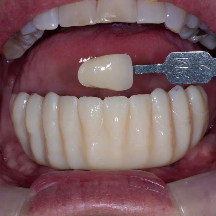 Step 7: Final Hybrid