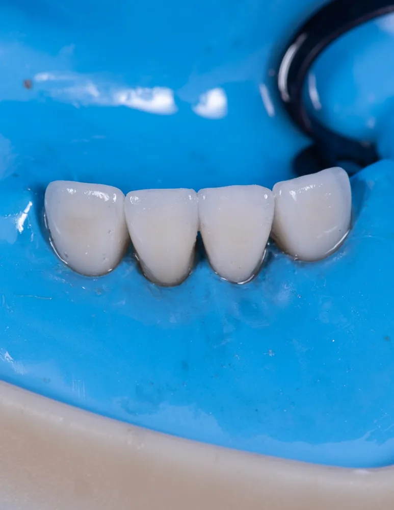 Step 8: Final Results